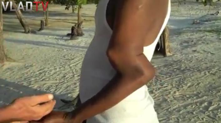 Man s Broken Arm Left Untreated For Two Years