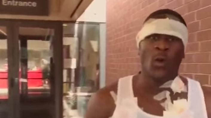 Vine Star Tyrone Hits Back At Rumors That He Was Shot In Chest