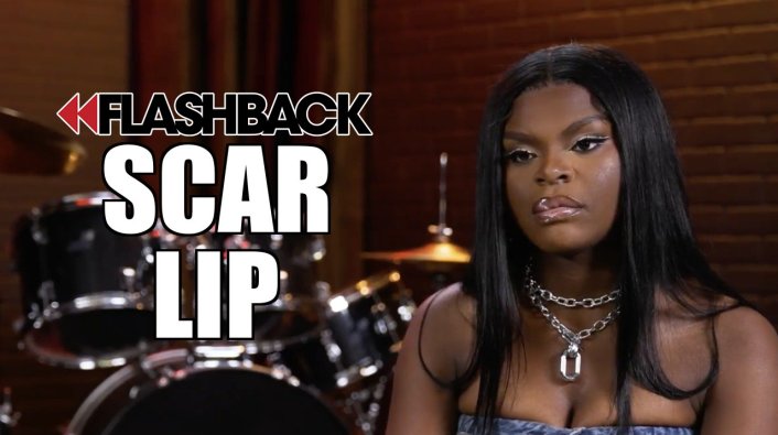 EXCLUSIVE: Scar Lip on How She Got the Scar on Her Lip (Flashback) | VladTV